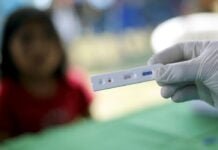 Custo do autoteste para covid-19 ameaça restringir acesso ao serviço