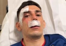 Ministério Público estuda impedir torcedores do Sport em jogos no Ceará