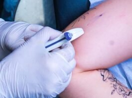 Paraíba vai ofertar contraceptivo subdérmico e capacita médicos e enfermeiros da Atenção Básica