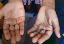 Paraíba registra 2ª maior taxa de denúncias contra crianças e adolescentes no Nordeste