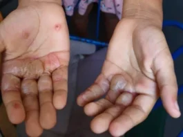 Paraíba registra 2ª maior taxa de denúncias contra crianças e adolescentes no Nordeste
