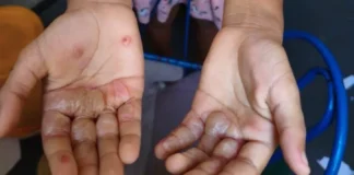 Paraíba registra 2ª maior taxa de denúncias contra crianças e adolescentes no Nordeste