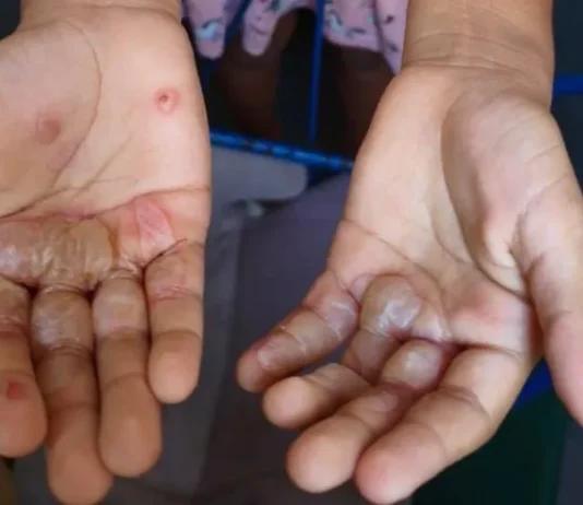 Paraíba registra 2ª maior taxa de denúncias contra crianças e adolescentes no Nordeste